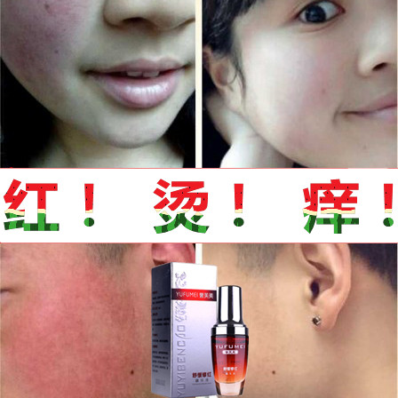 修复增厚角质层薄祛红脸蛋去除红血丝抗敏感肌肤护肤面霜正品舒缓