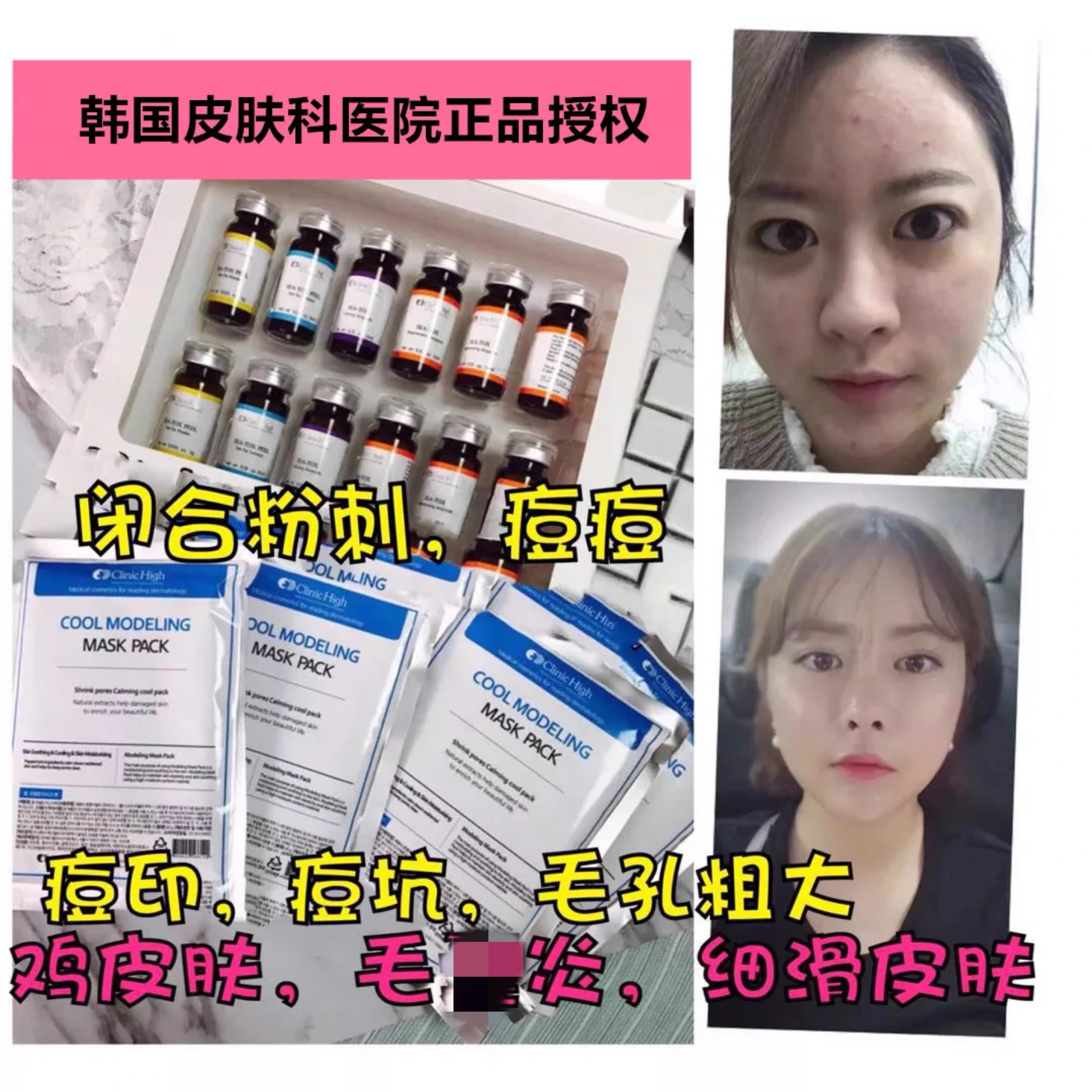seatox海藻矽针硅针阿拉丁焕肤套盒韩国clinic high祛痘印闭口