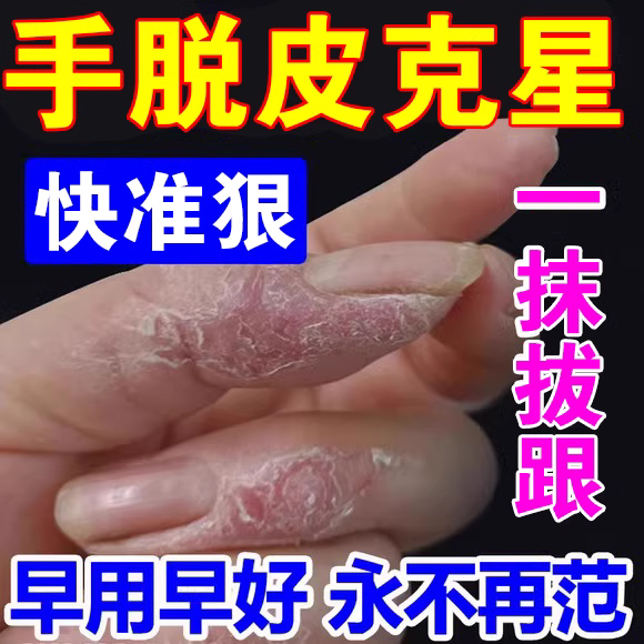 手足脱皮严重脱皮专用抑菌膏真菌手指手掌干燥起皮掉皮脚底开裂药