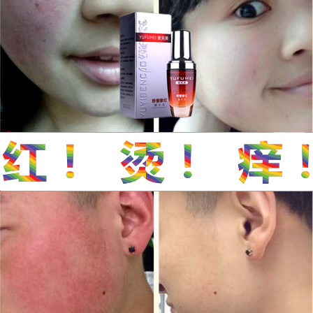抗敏感坑过敏皮肤修复角质层薄霜祛脸部红血丝保湿去脸红皮肤屏障