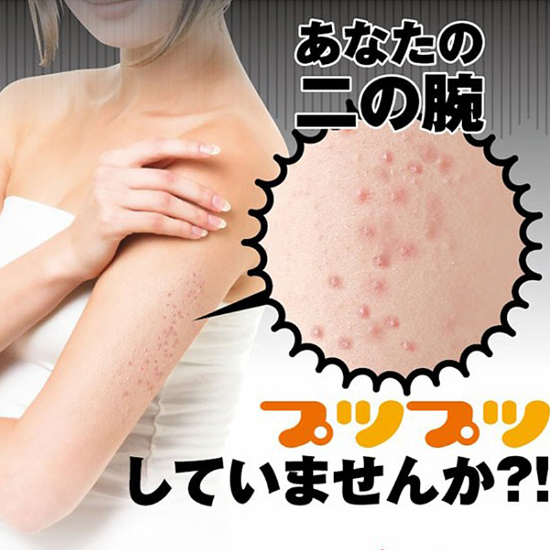 日本制去鸡皮美体霜睡眠去胳膊腿部鸡皮肤疙瘩去角质改善肌肤粗糙